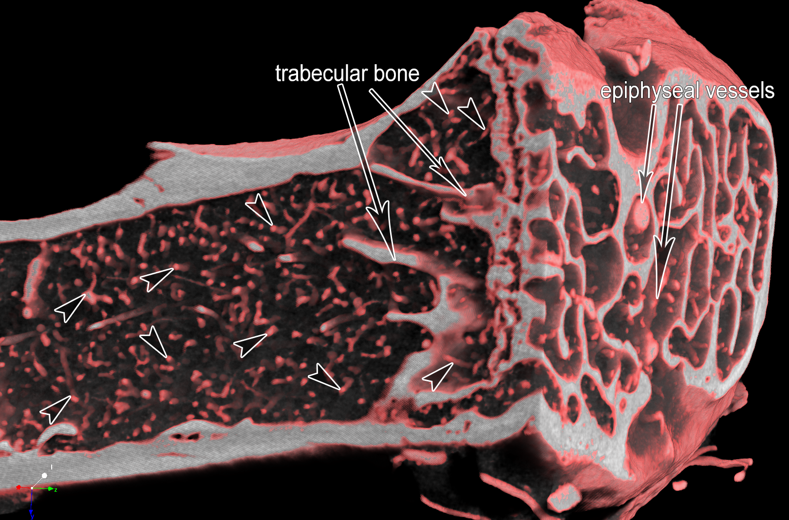 Figure 1: microangioCT of proximal murine tibia of a 21-month-old VEGF transgenic male mouse. After perfusion with µAngiofil the murine tibia was harvested, fixated in 4% PFA and imaged by microCT. Arrowheads mark microvessels within the tibia. The diameter of the tibia shaft is around 1 mm. On the right side of the image one can distinguish the bigger epiphyseal vessels. The bone tissue appears white at the plane of the virtual section through the microCT-dataset.