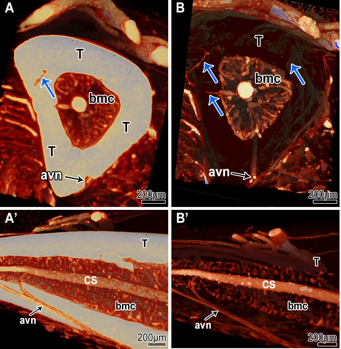Figure 2: microangioCT-based visualization of the diaphysis of CB17SCID mice tibia before (A & A’) and after decalcification with 10% EDTA (B & B’). In A and A’ the tibia bone appears brighter and opaque due to higher X-ray absorption. In B and B’ the tibia bone appears transparent due to its lowered X-ray absorption after decalcification. Due to the decalcification, connecting vessels between the periosteal vessels and the vessels of the bone marrow cavity (bmc) are more easily detectable (blue arrows in A vs. B). The visualization of the vessels within the medullar cavity (central sinus (CS)) is also improved. At the external surface of the tibia, supplying arteries are visible (arteria et vena nutricia (avn)).