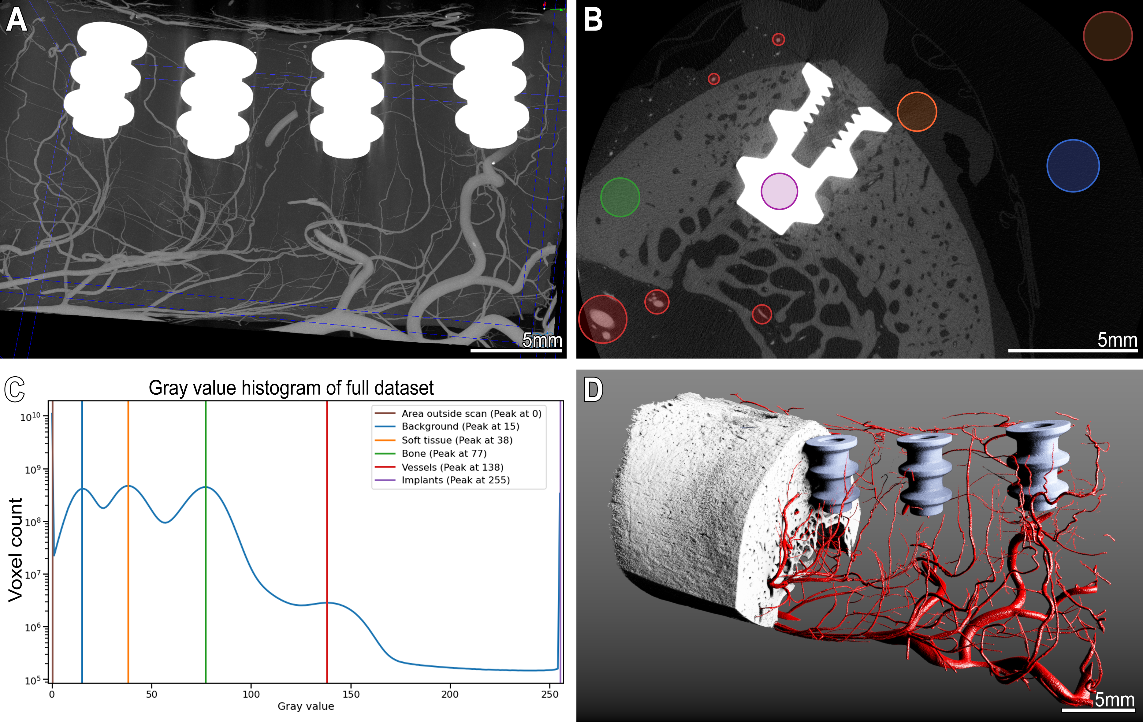 Figure 6: microangioCT of the peri-implant vasculature of a minipig mandibula. Panel A: Maximum intensity projection image of the minipig mandible dataset with 4 metal implants and µAngiofil-perfused vessels. Panel B: virtual transversal section through the dataset showing an implant within the mandible. The colored circles mark structures with different gray values ranges. Corresponding peaks with color legend are marked on the histogram in panel C. Such differences in gray levels allow a straightforward segmentation of the structures of interest as displayed in the 3D visualization in panel D.