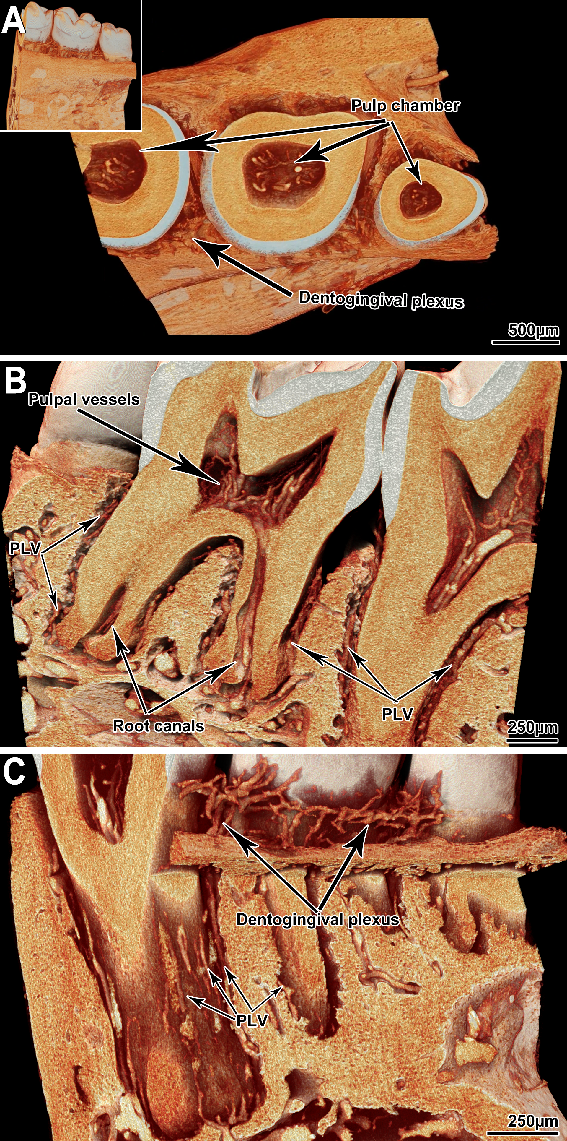 Figure 4: microAngioCT of the vasculature of C57BL/6 mice teeth. A: View onto a virtual section parallel to the crowns of the murine teeth: pulp chambers are visible, and the pulpal vessels are presented. The inset shows a full view of the tomographic dataset. B: Sagittal section through the mandible. The microvessels within the pulp cavities and root canals are distinguishable. C: Detailed view of the dentogingival plexus and periodontal ligament vessels (PLV).