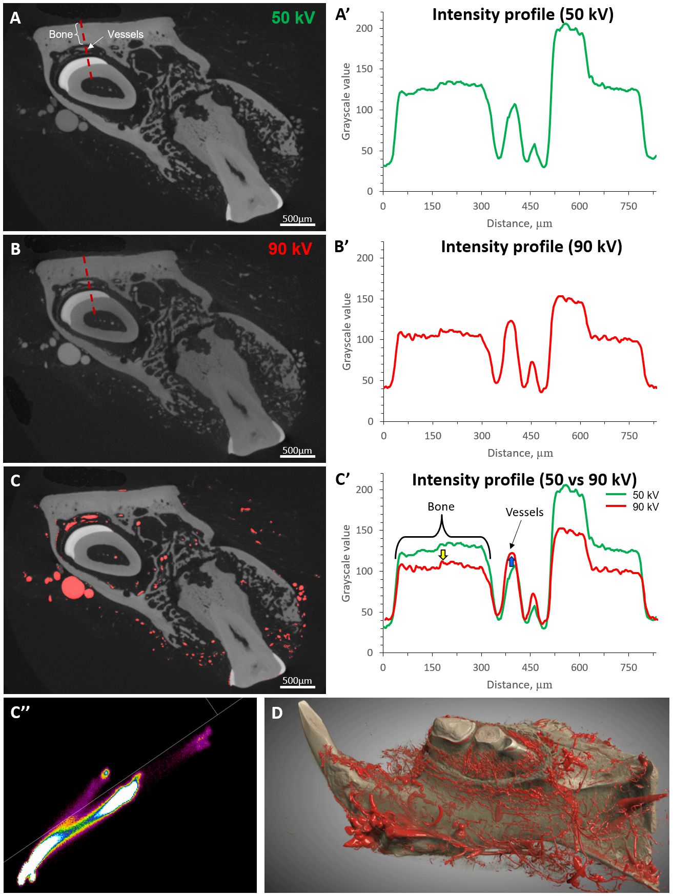 Figure 7: Dual-energy microAngioCT of a murine mandibula. Panel A and B represent virtual sections through the microCT datasets obtained at different accelerating voltages: 50 kV (A) and 90 kV (B). The dashed red line in panels A and B represents the location of the corresponding intensity profile displayed in panels A’ and B’. Panel C represents segmented vasculature using the dual-energy approach. The changes in the intensity profiles of different tissues are shown in graph C’: with the higher voltage (90 kV) the intensity of bone tissue reduces (yellow arrow) and the intensity of vessels (μAngiofil) increases. Such changes in gray levels allow segmentation of the vessels using the combined histogram shown in panel C’’ (DEhist, Bruker microCT N.V., Kontich, Belgium). Panel D represents a three-dimensional visualization of the segmented tissues (Dragonfly 3D World (2024.1), Comet Technologies Canada Inc., Montréal, Canada).